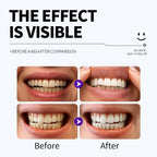 PAP+ Purple Whitening Strips (14 Strips)
