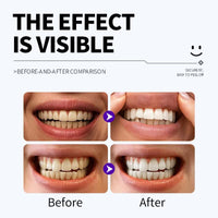 PAP+ Purple Whitening Strips (14 Strips) view 4